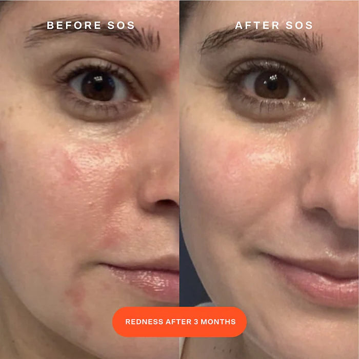 Mini SOS Daily Rescue Facial Spray - TOWER 28 BEAUTY